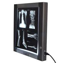 x-ray-view-box-at-low-price